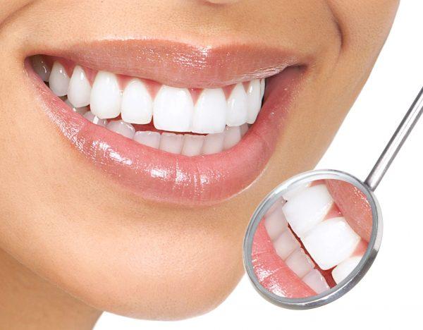 Bọc răng sứ là bí quyết để có hàm răng trắng khỏe