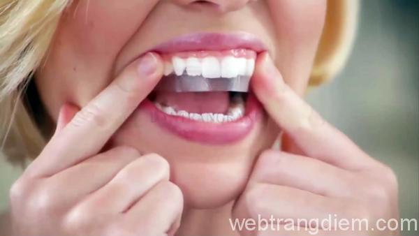 Dùng miếng dán trắng răng là bí quyết để có hàm răng trắng khỏe