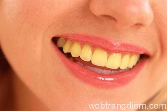 Bí quyết để có hàm răng trắng khỏe không ố vàng